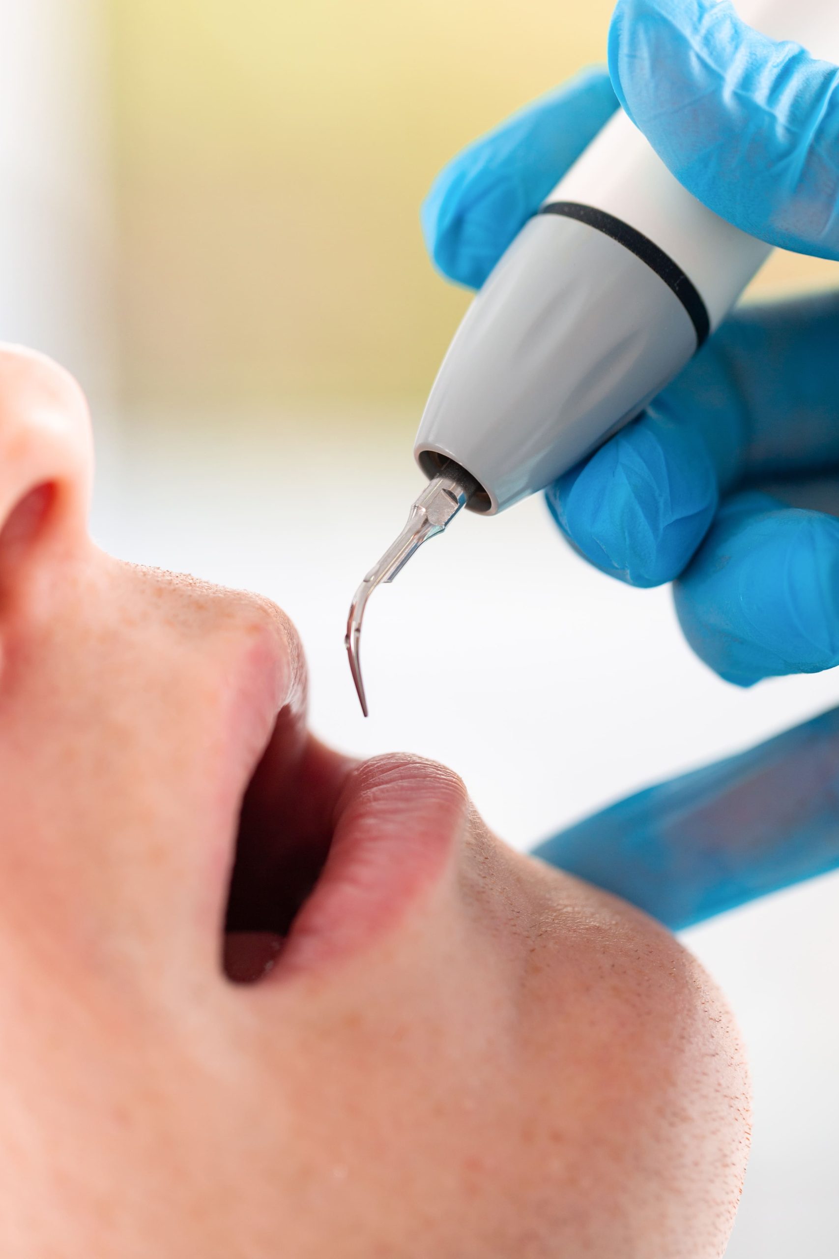 θεραπεια ουλων (1)